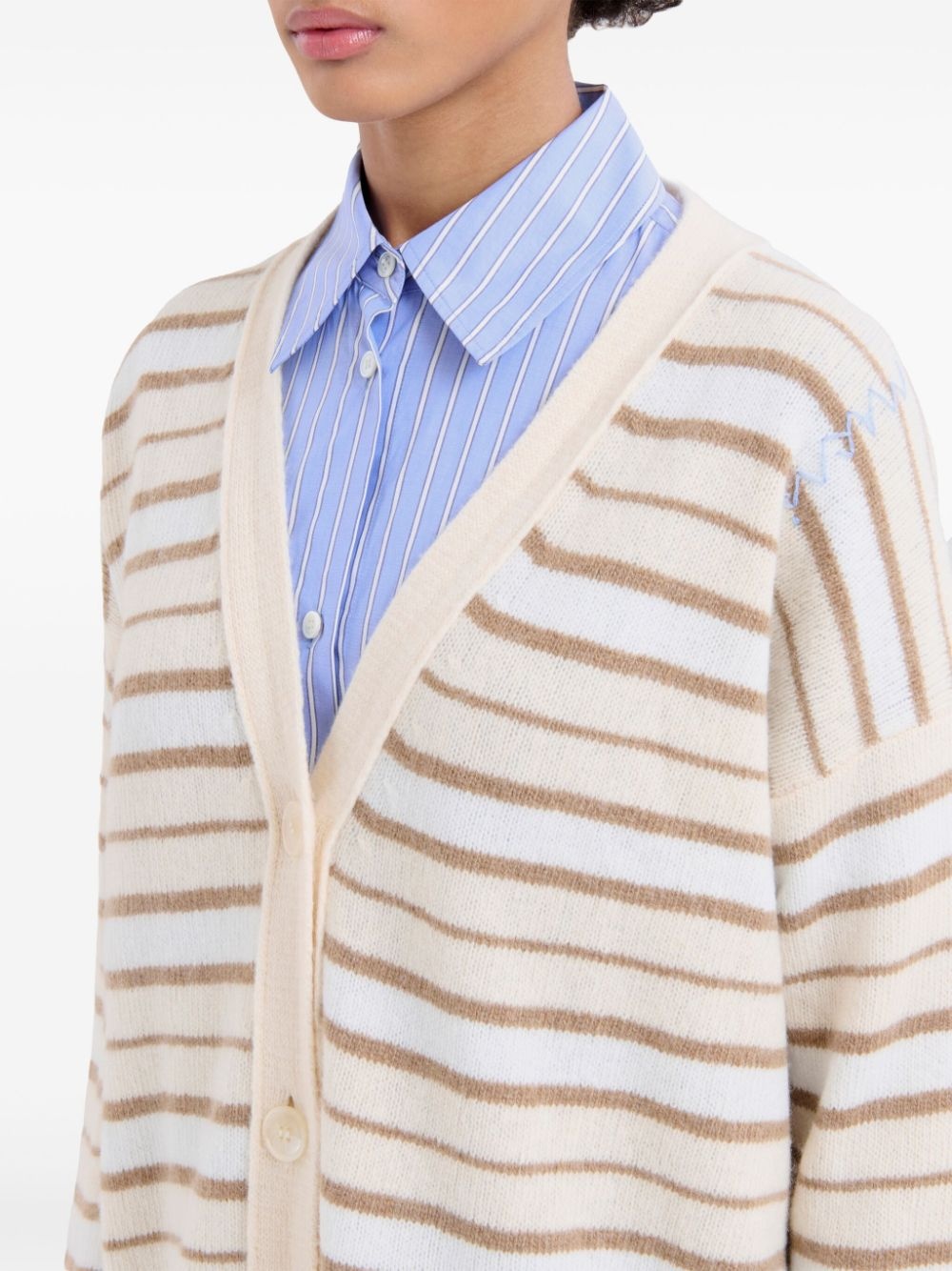 striped cardigan - 5