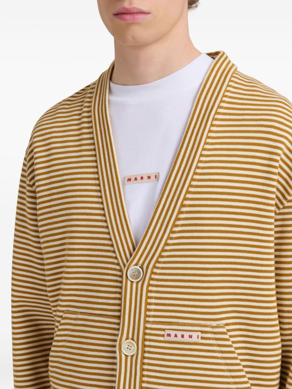 striped button-up cardigan - 5