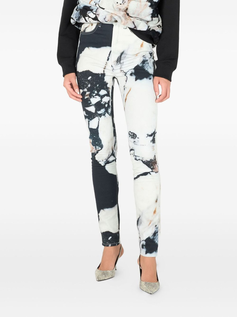 marble-print skinny trousers 3