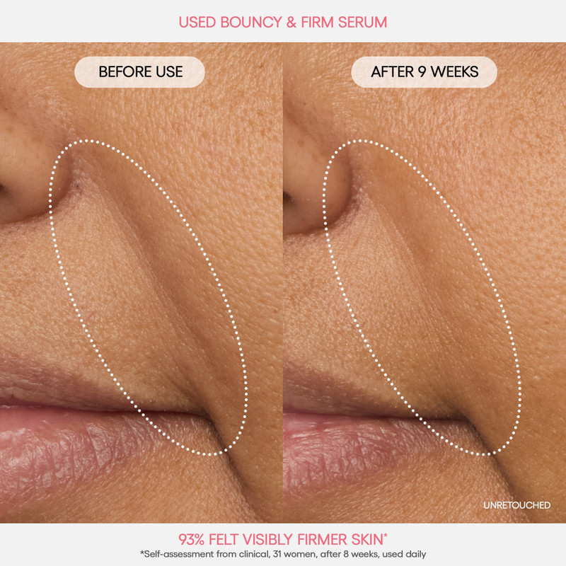 Bouncy Skin On The Go 7