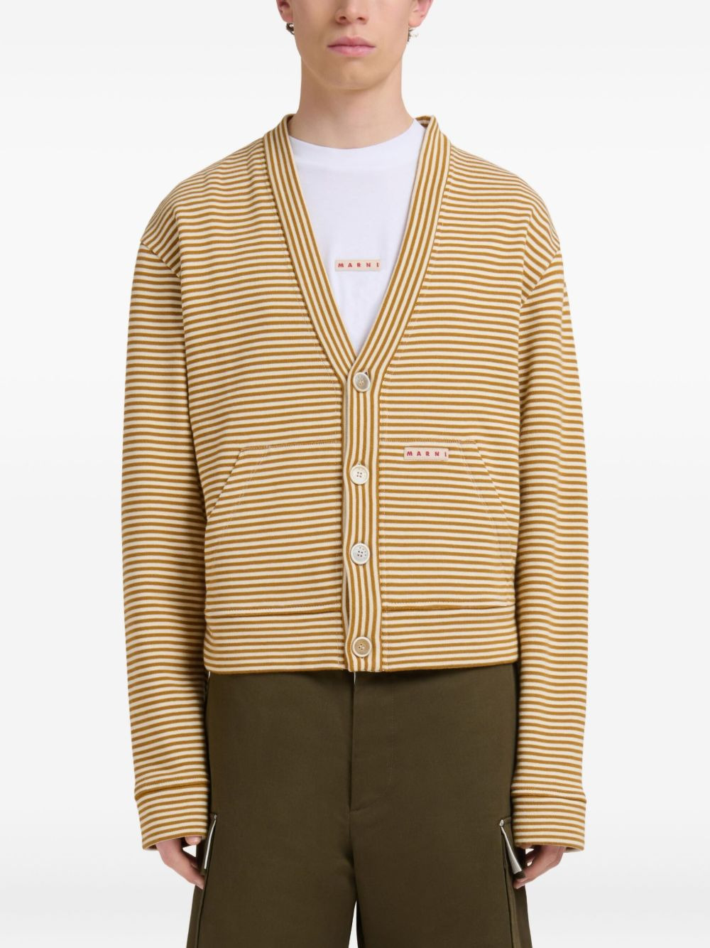 striped button-up cardigan - 3
