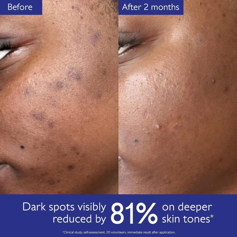 Vinoperfect Brightening Routine for Dark Spots and Uneven Skin Tone 3