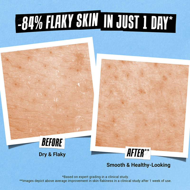 Ultra Facial Skin Barrier Repair Balm with Squalane 3