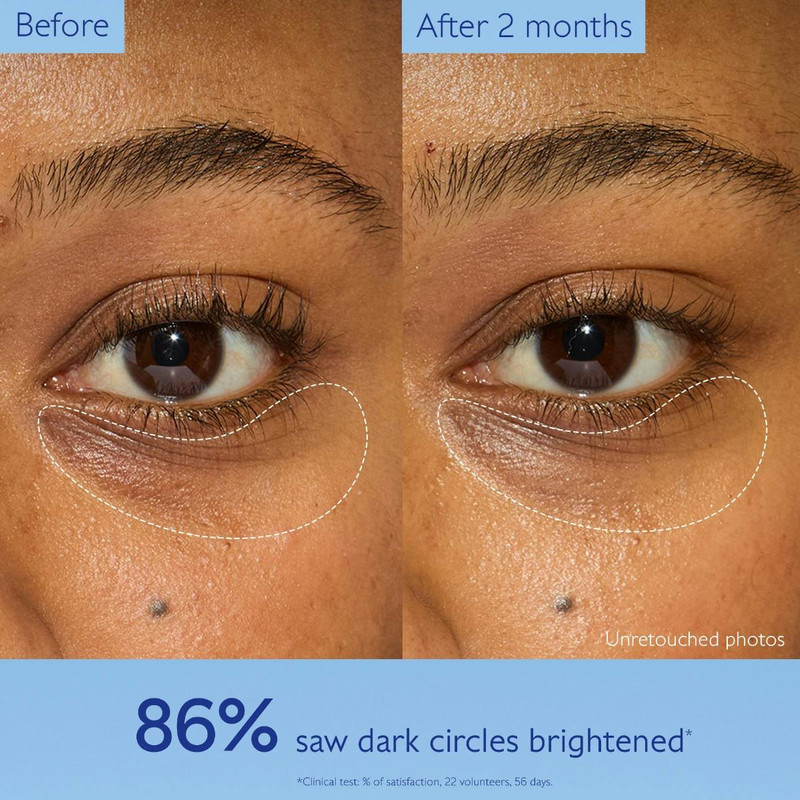 Dark Circle Brightening Eye Cream with Niacinamide 5