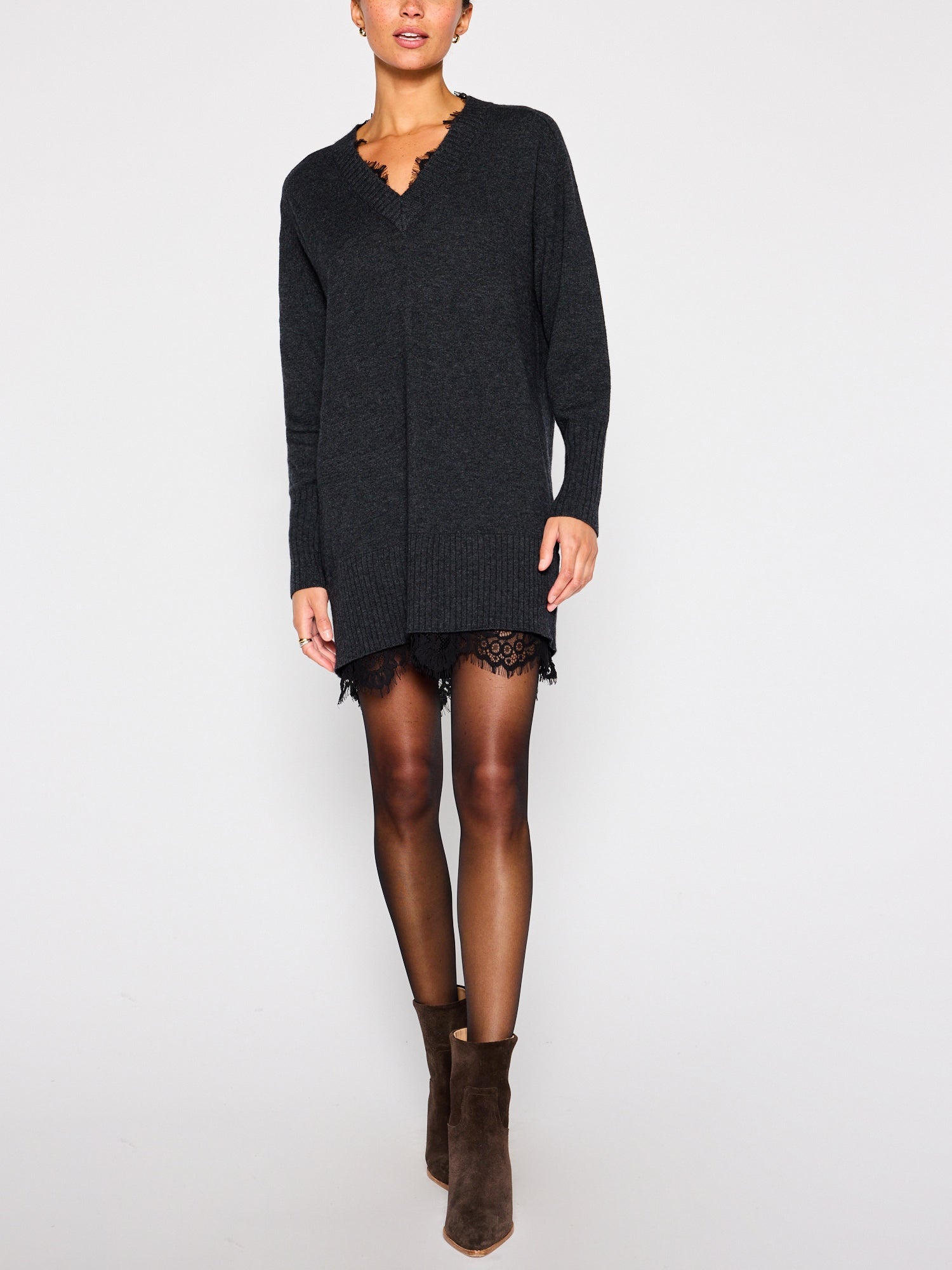 The Amiri Lace Dress - 2