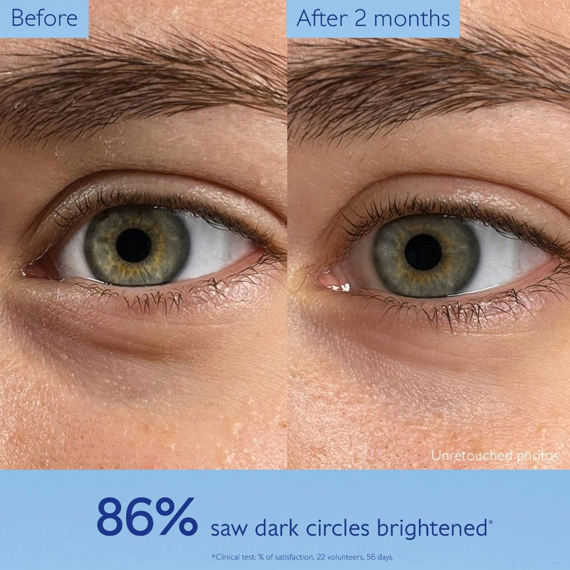 Dark Circle Brightening Eye Cream with Niacinamide 6