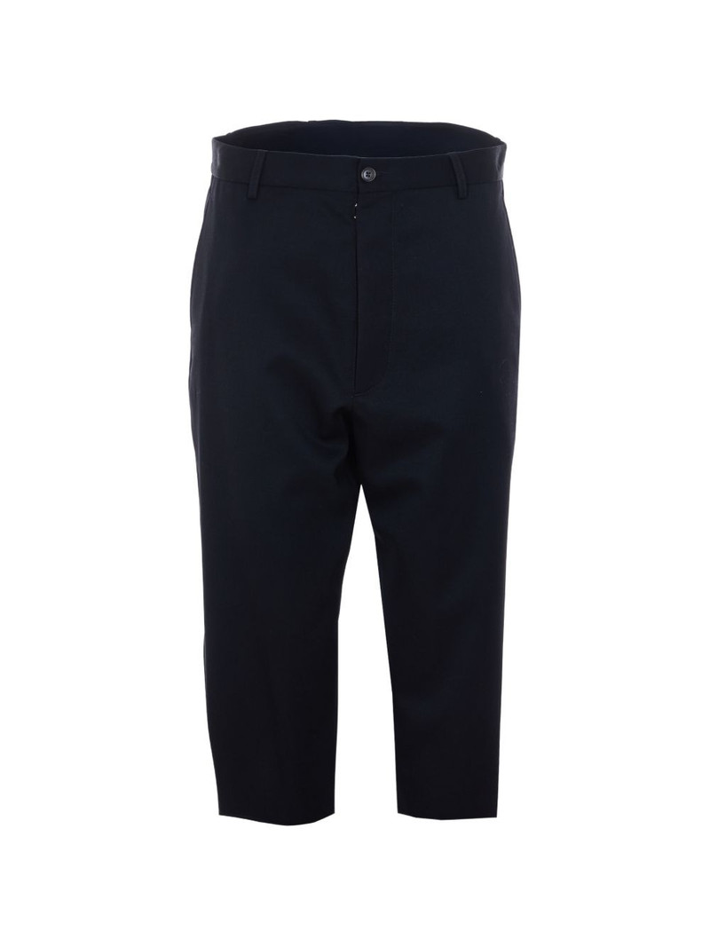 zip loose shorts 1