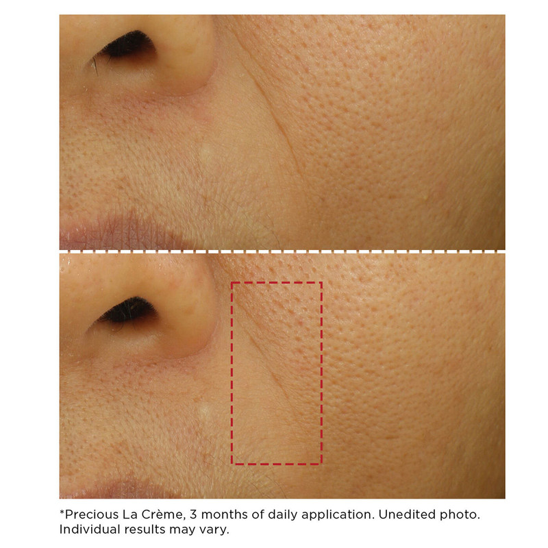 Precious Duo | Luxury Anti-Aging Face & Eye Creams | Targets Wrinkles, Puffiness & Dark Circles 4