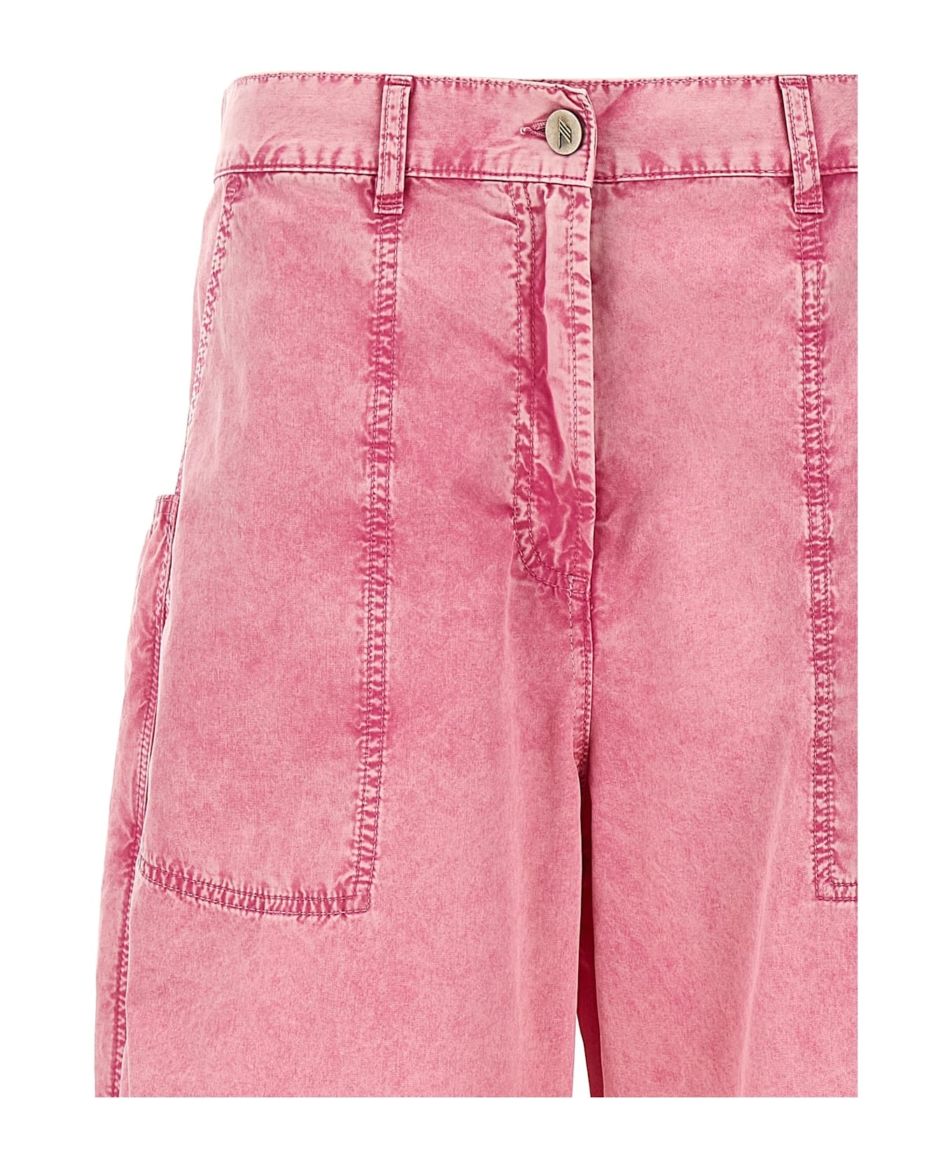 Baggy Pants - 3