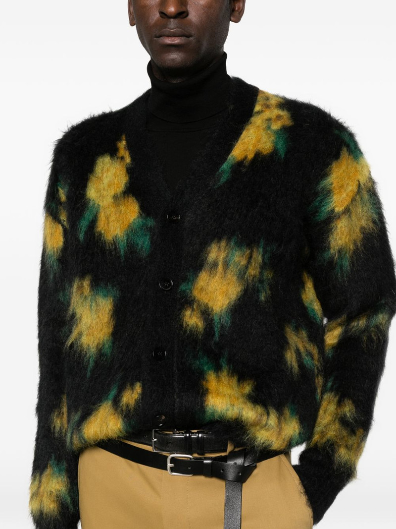 buttoned cardigan 5