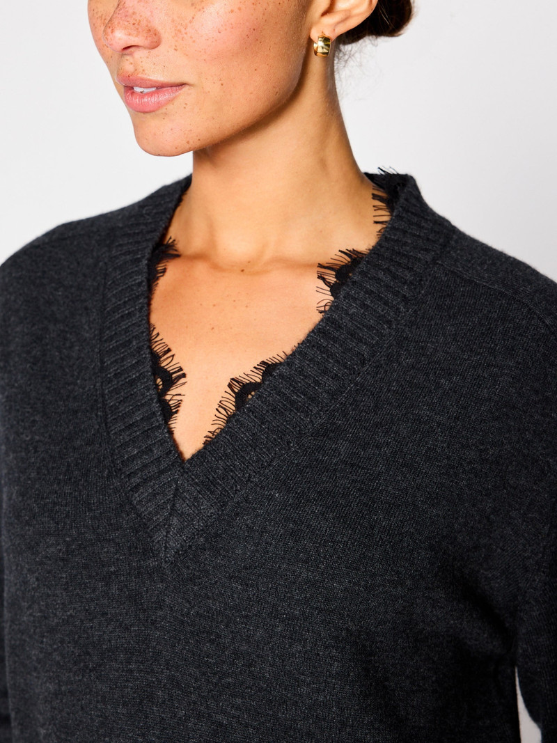 The Amiri Lace Dress 5