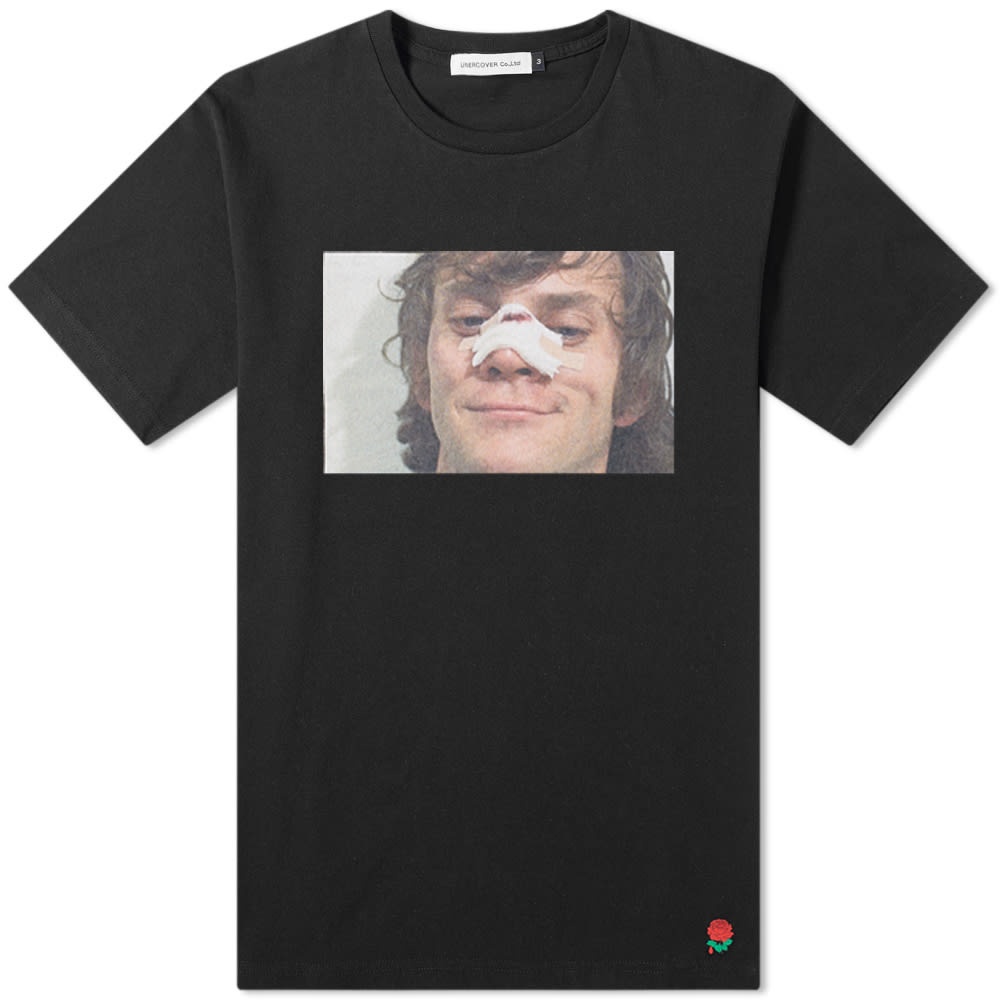 Undercover x A Clockwork Orange Alex Nose Print Tee - 1