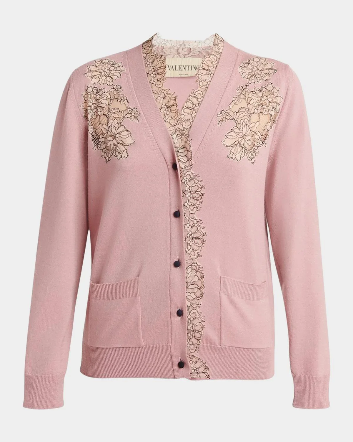Scalloped Lace V-Neck Cardigan - 1