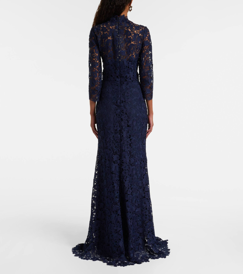Lace gown 3