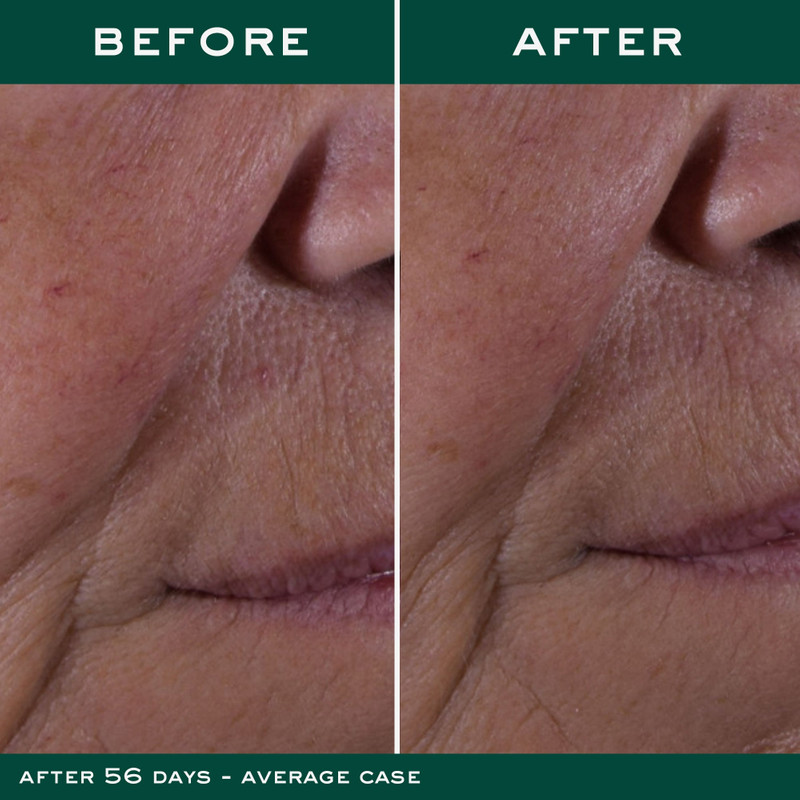 The Global Anti-Aging Cream 5