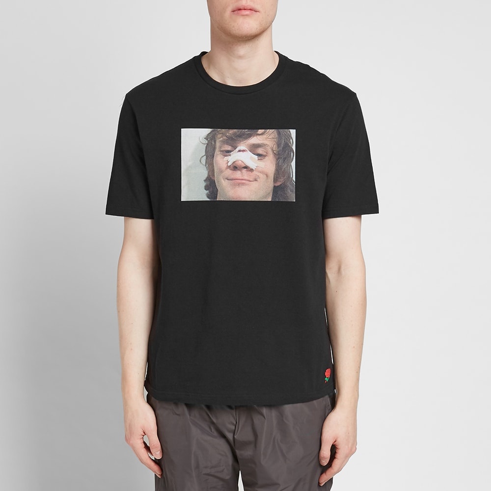 Undercover x A Clockwork Orange Alex Nose Print Tee - 4