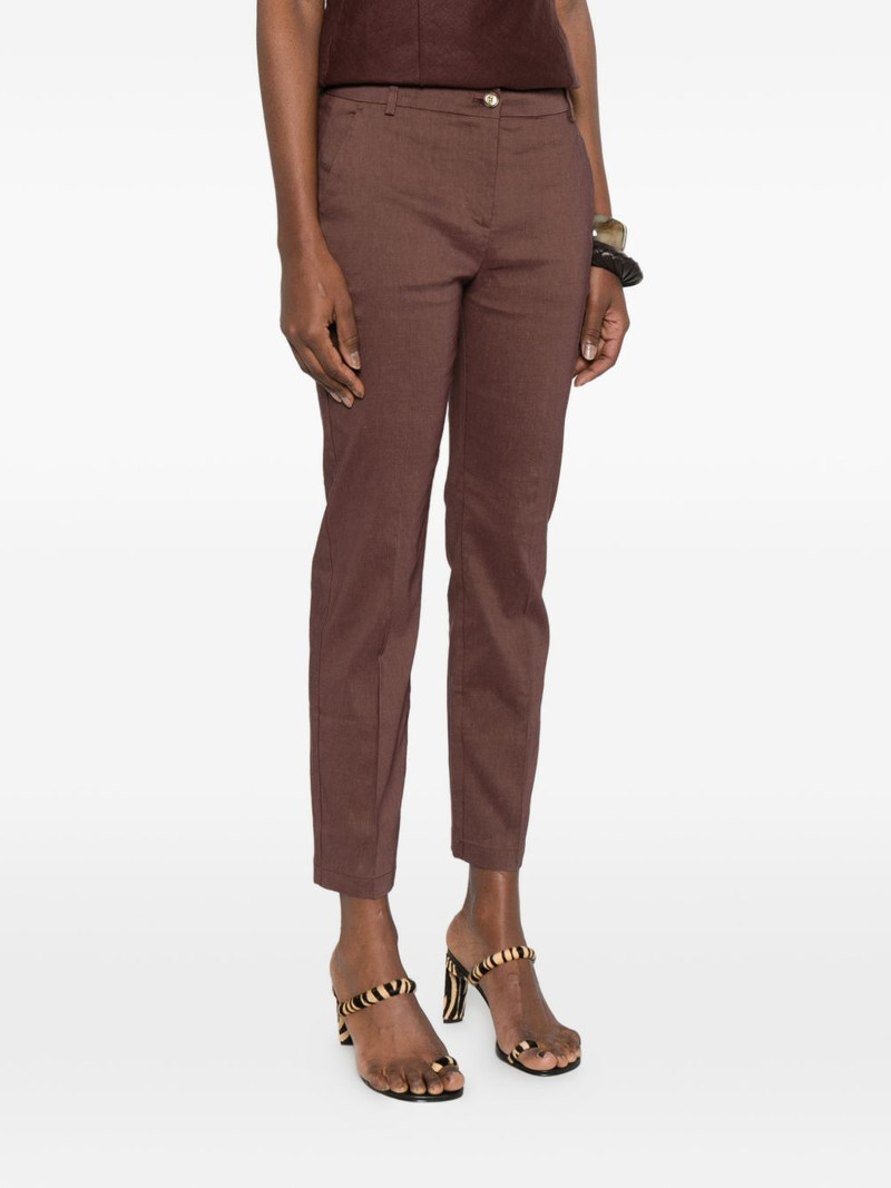 belt-loops trousers 3
