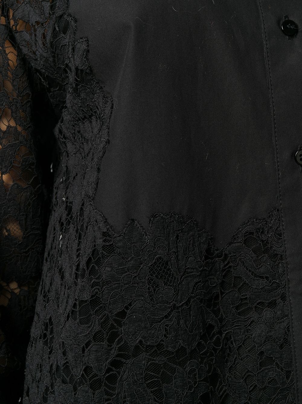 short button-up lace dress - 5