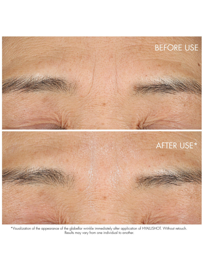 Women's Dior Capture Totale Hyalushot: Wrinkle Corrector With Hyaluronic Acid 3