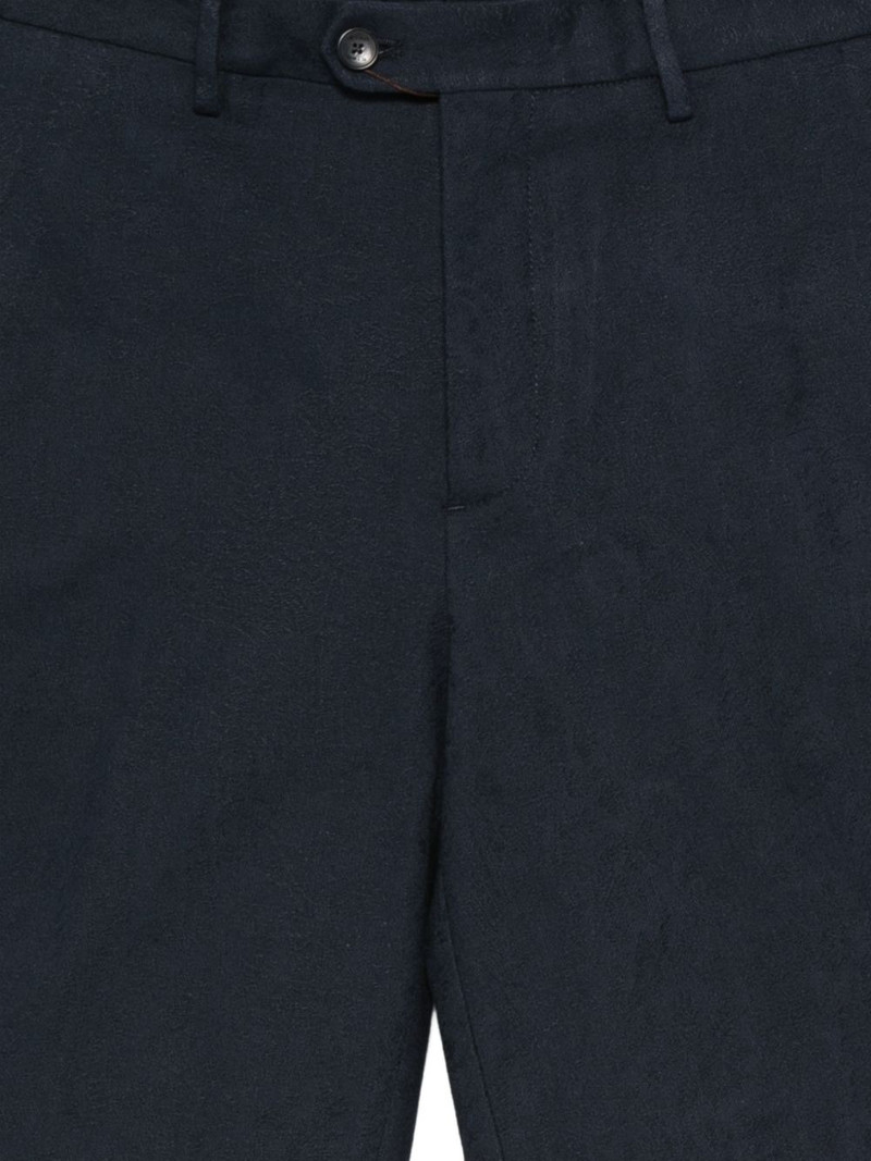 button shorts 3