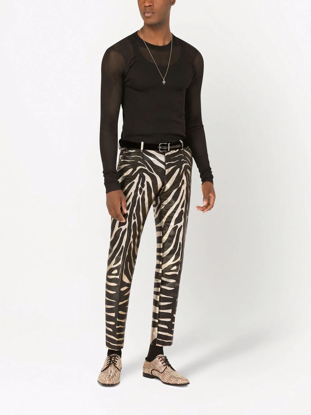 zebra print trousers - 2