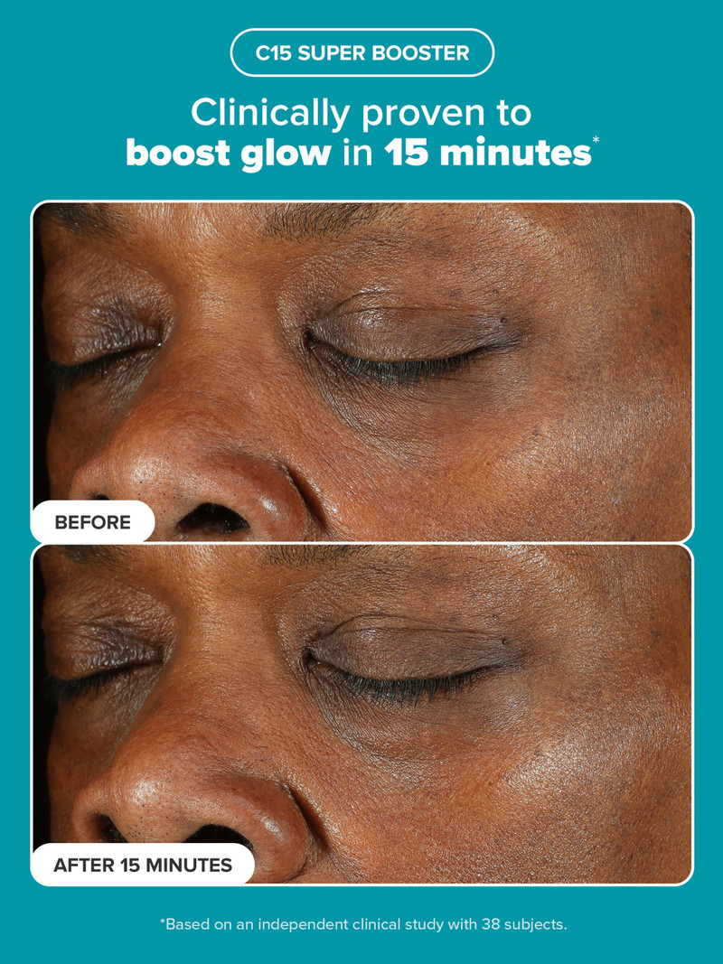 Clarify, Even & Brighten Kit 5