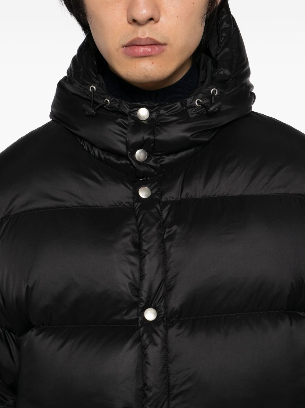 removable-collar coat - 5