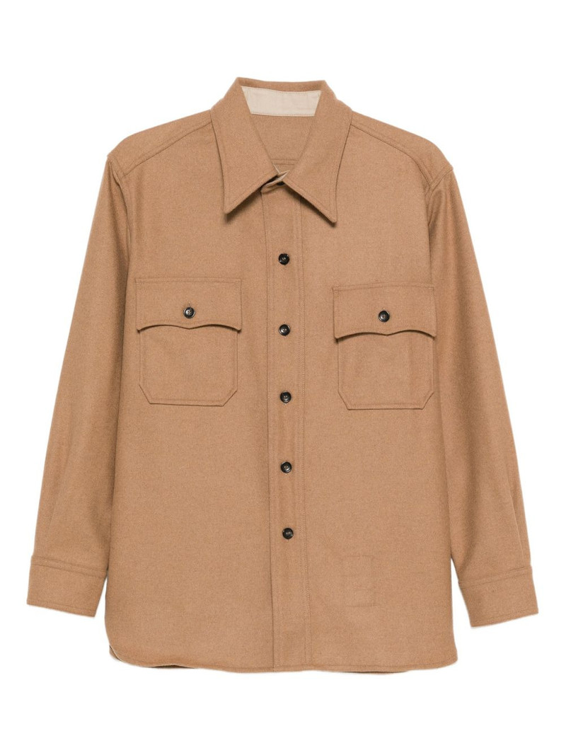 button overshirt 1