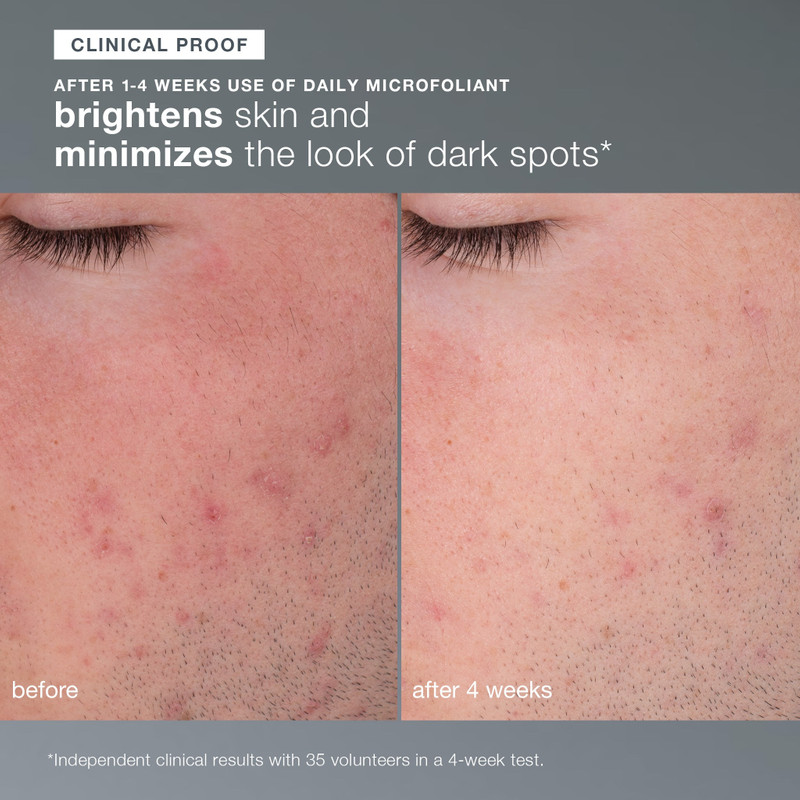 skin transformation duo 5