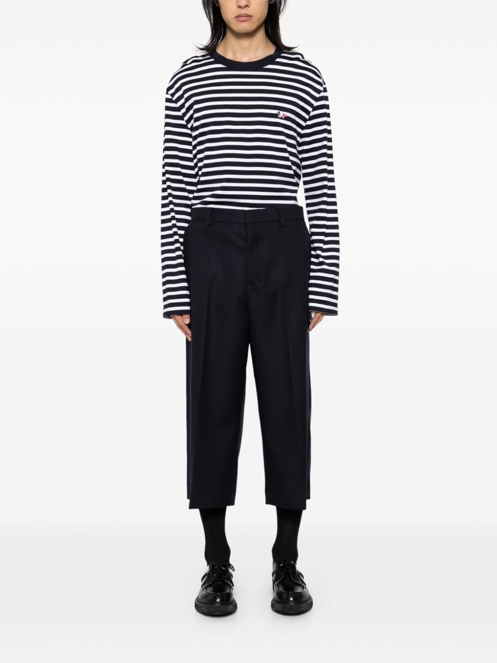 button fastening shorts - 2