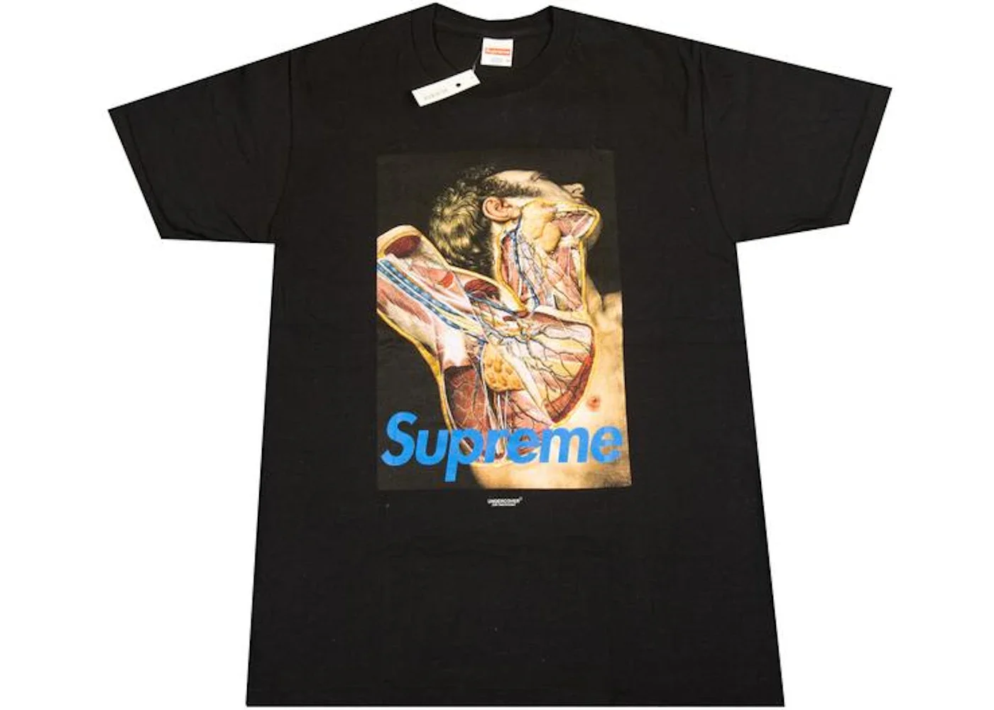 Supreme Undercover Anatomy Tee Black - 1