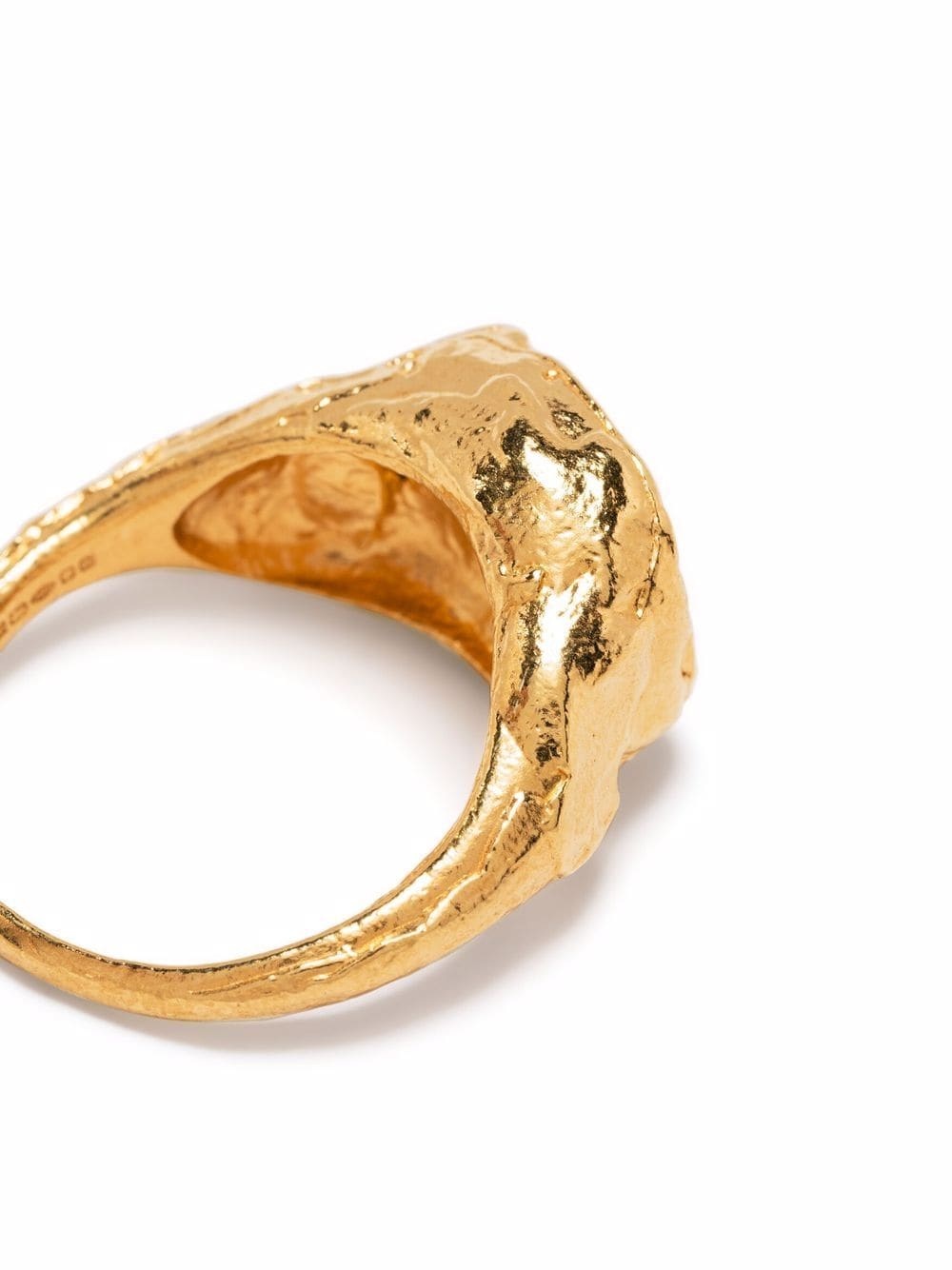 Cancer signet ring - 3