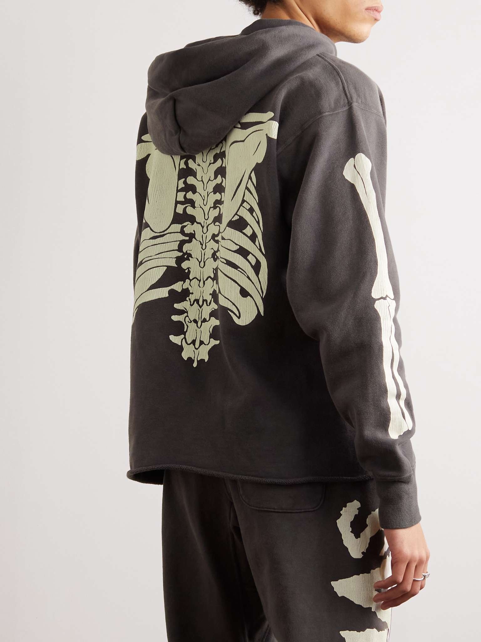 Distressed Printed Cotton-Jersey Hoodie - 3