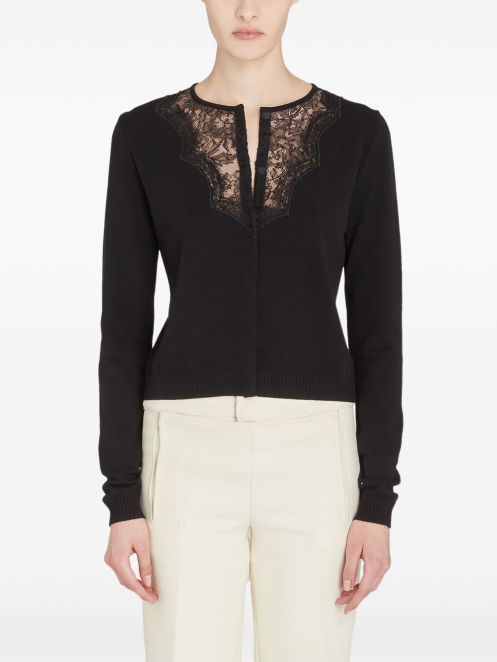 lace detailing cardigan - 2